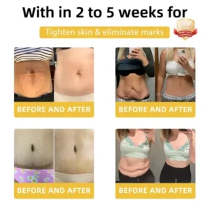 𝐁𝐞𝐞 𝐕𝐞𝐧𝐨𝐦 𝐃𝐞𝐭𝐨𝐱 𝐄𝐥𝐢𝐱𝐢𝐫 – 𝐋𝐢𝐩𝐨𝐭𝐫𝐨𝐩𝐢𝐜 & 𝐅𝐢𝐫𝐦𝐢𝐧𝐠 𝐃𝐮𝐨