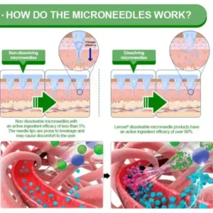 𝑵𝒂𝒏𝒐 𝑴𝒊𝒄𝒓𝒐𝒏𝒆𝒆𝒅𝒍𝒆 𝑷𝒂𝒕𝒄𝒉
