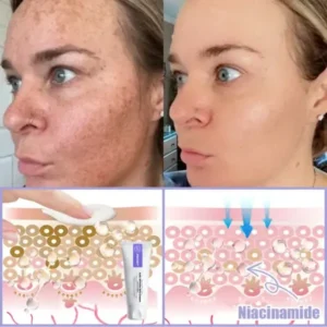 Anti-Wrinkle Skin Cream for Remove Wrinkles