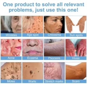 Bee Bright Multi-Symptom Skin Treatment Cream