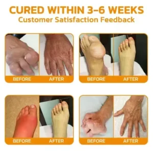 Bee Venom Pain Suppression Joint Healing Cream