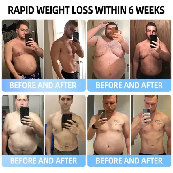 Nano Microneedle Patch with SMGT-GLP-1 & Matrixyl 3000