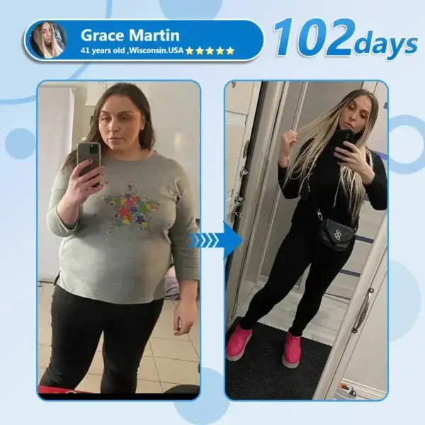 Nano Microneedle Patch with SMGT-GLP-1 & Matrixyl 3000