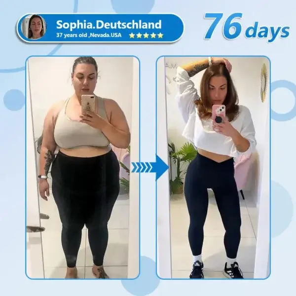 Nano Microneedle Patch with SMGT-GLP-1 & Matrixyl 3000