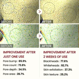 Peel Shot Glow Black Rice Ampoule