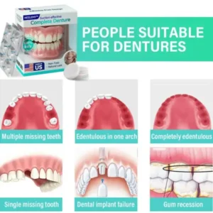 Suction-fit Complete Denture