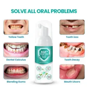 Teeth Mouthwash – Solve all Oral Problems