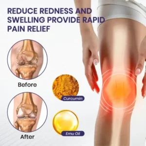 Turmeric & Emu Oil Arthritis Soothing Pain Relief Massage Gel