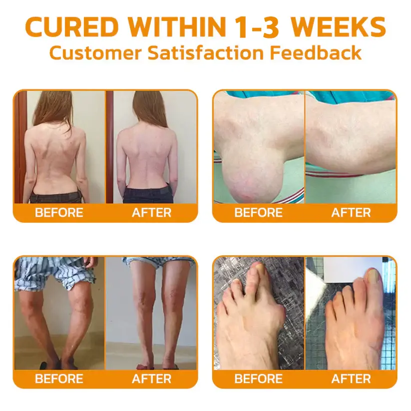 Magnesium Oil & Bee Venom Joint Healing Spray - Image 4