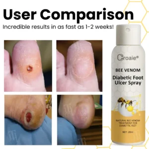Alternative view of Bee Venom Diabetic Foot Ulcer Spray