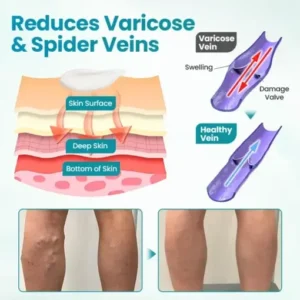 Alternative view of VeinAway Relief Cream