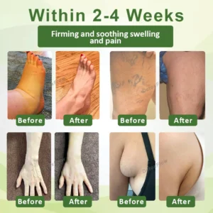 Alternative view of Advanced SwellCare Lymphatic Cream