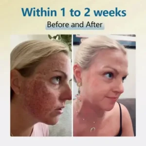 Alternative view of Bean Essence Serum