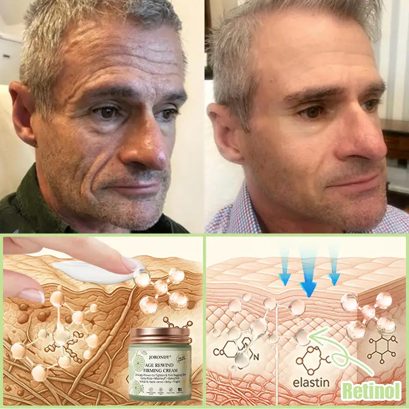 Firming Cream——Visibly Firms in Just 21 Days – Without Surgery or Irritation - Image 10