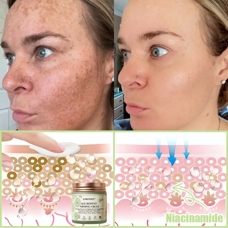 Firming Cream——Visibly Firms in Just 21 Days – Without Surgery or Irritation - Image 11