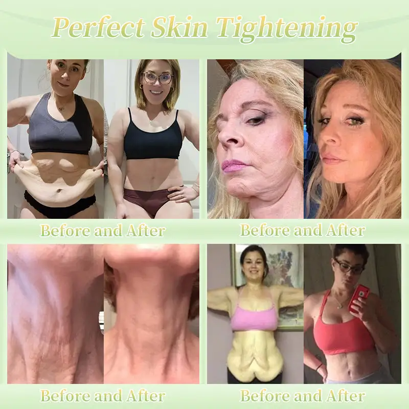 Firming Cream——Visibly Firms in Just 21 Days – Without Surgery or Irritation - Image 3