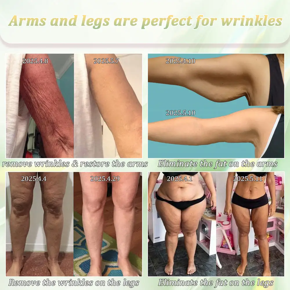 Firming Cream——Visibly Firms in Just 21 Days – Without Surgery or Irritation - Image 4