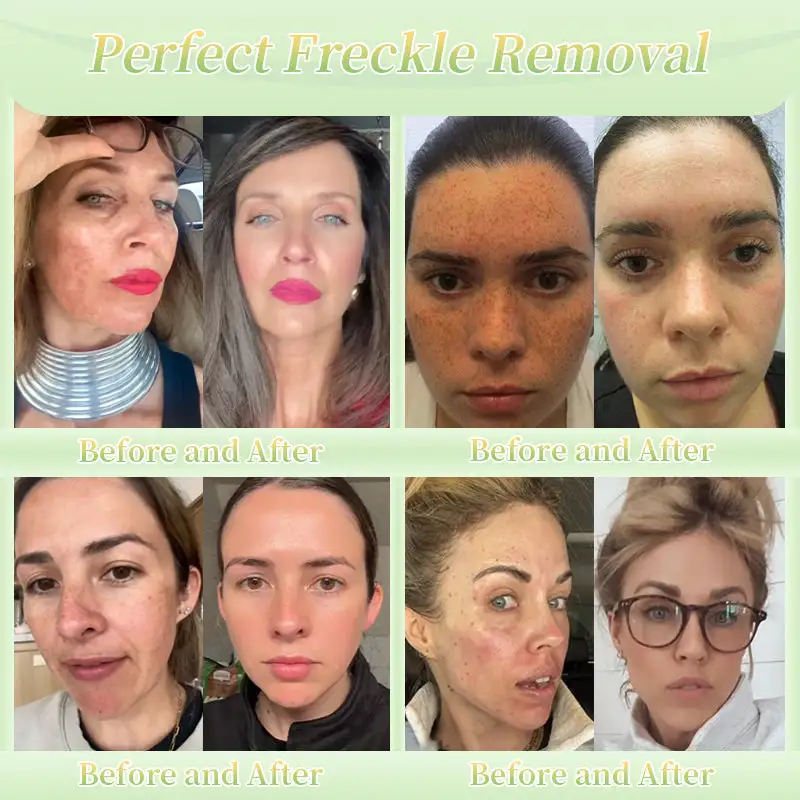 Firming Cream——Visibly Firms in Just 21 Days – Without Surgery or Irritation - Image 5