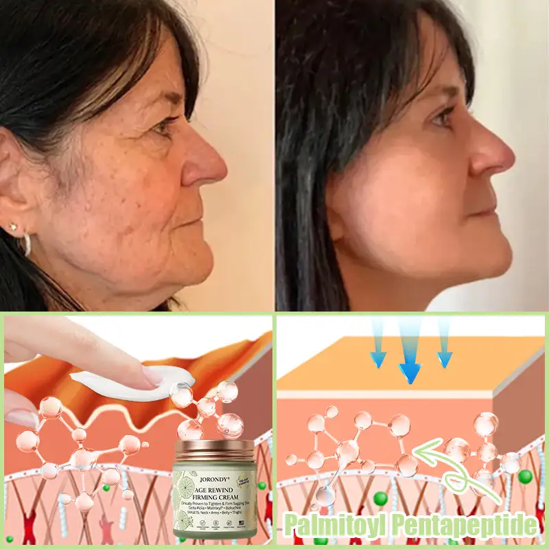 Firming Cream——Visibly Firms in Just 21 Days – Without Surgery or Irritation - Image 9