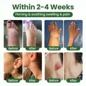 Alternative view of BodyRelief Circulation Cream