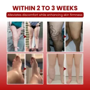 Alternative view of SwellCare Professional Lymphatic Drainage Massage Cream