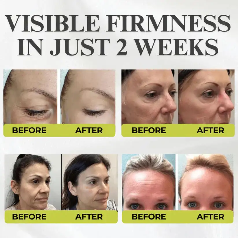 Botox & Vita-A Retinol Shot Wrinkle-Lift Tightening cream - Image 5